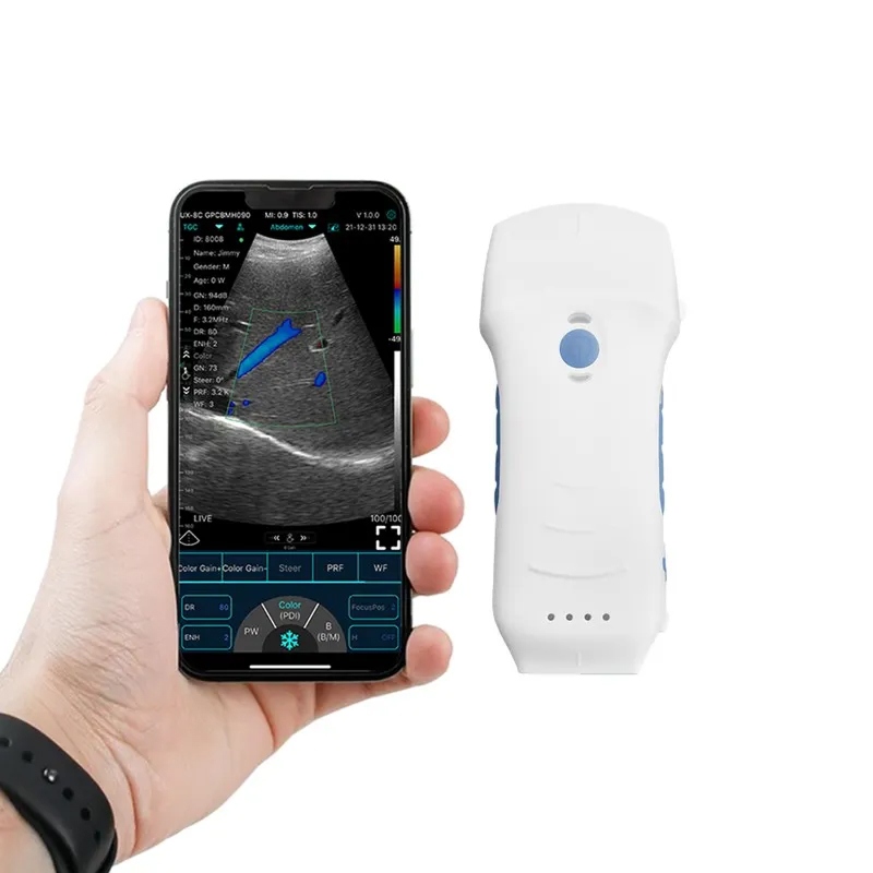 Ecógrafo Portátil C10TX (Sonda Convex y lineal) Ecógrafo Portátil C10TX (Sonda Convex y lineal)
